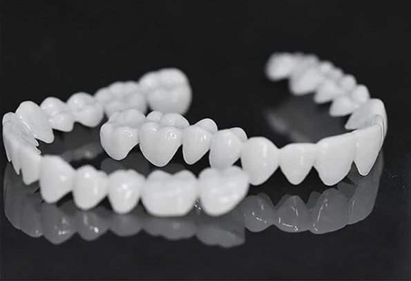 Prothèse blanche ajustable Smile Lens – Dispositif de correction directe du sourire