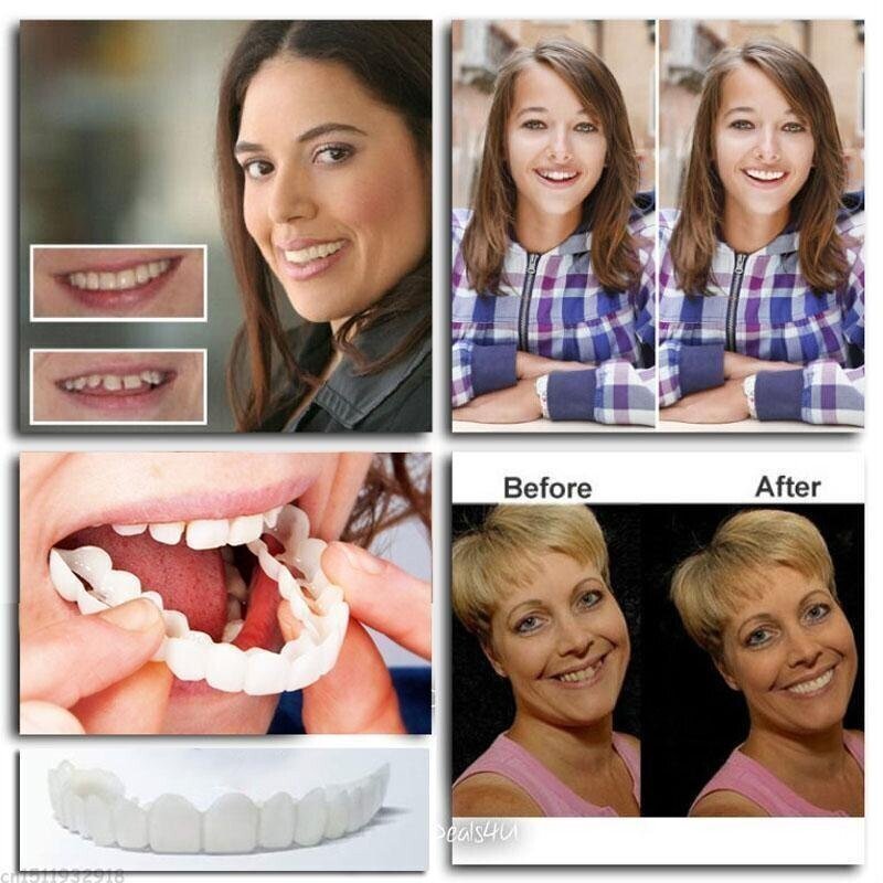 Dentiere a scatto regolabili — vestibilità precisa