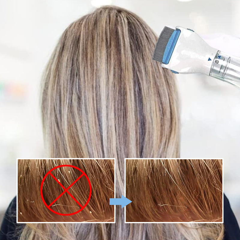 V-Comb-Kopfläusegerät - 3 austauschbare Filter und LED-Erkennung mit blauem Licht
