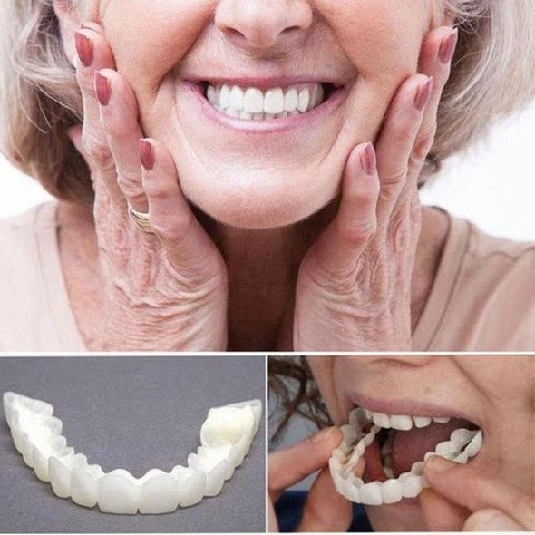 Juego completo de carillas On Smile — Incluye maxilar superior e inferior