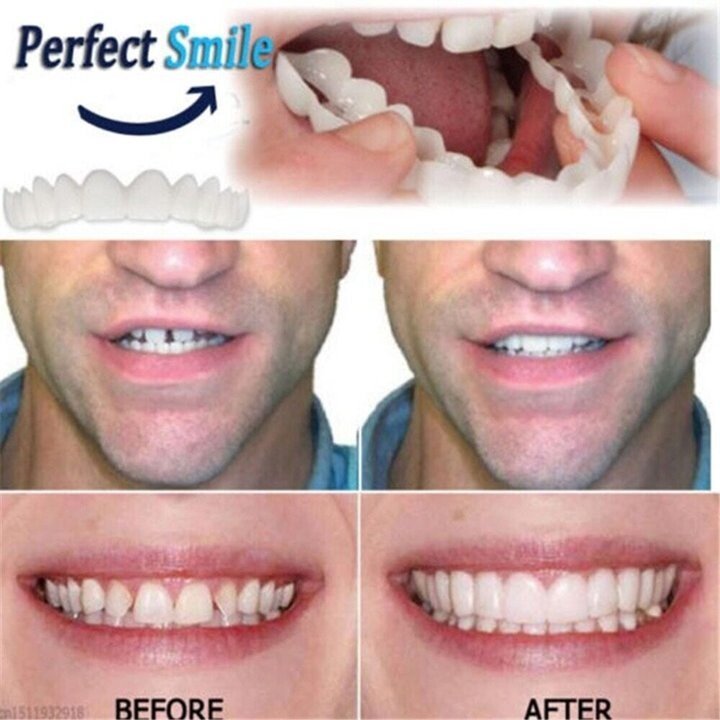 Dentiere a scatto regolabili — vestibilità precisa