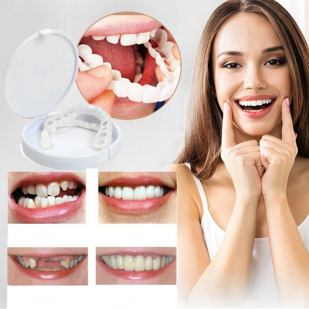 Kit de Sorriso Cosmético Instantâneo RYNX Repair — Capas Dentárias Concebidas por Dentistas