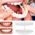 Juego completo de carillas On Smile — Incluye maxilar superior e inferior