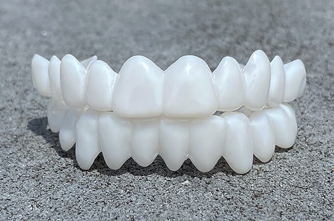 Prothèse blanche ajustable Smile Lens – Dispositif de correction directe du sourire