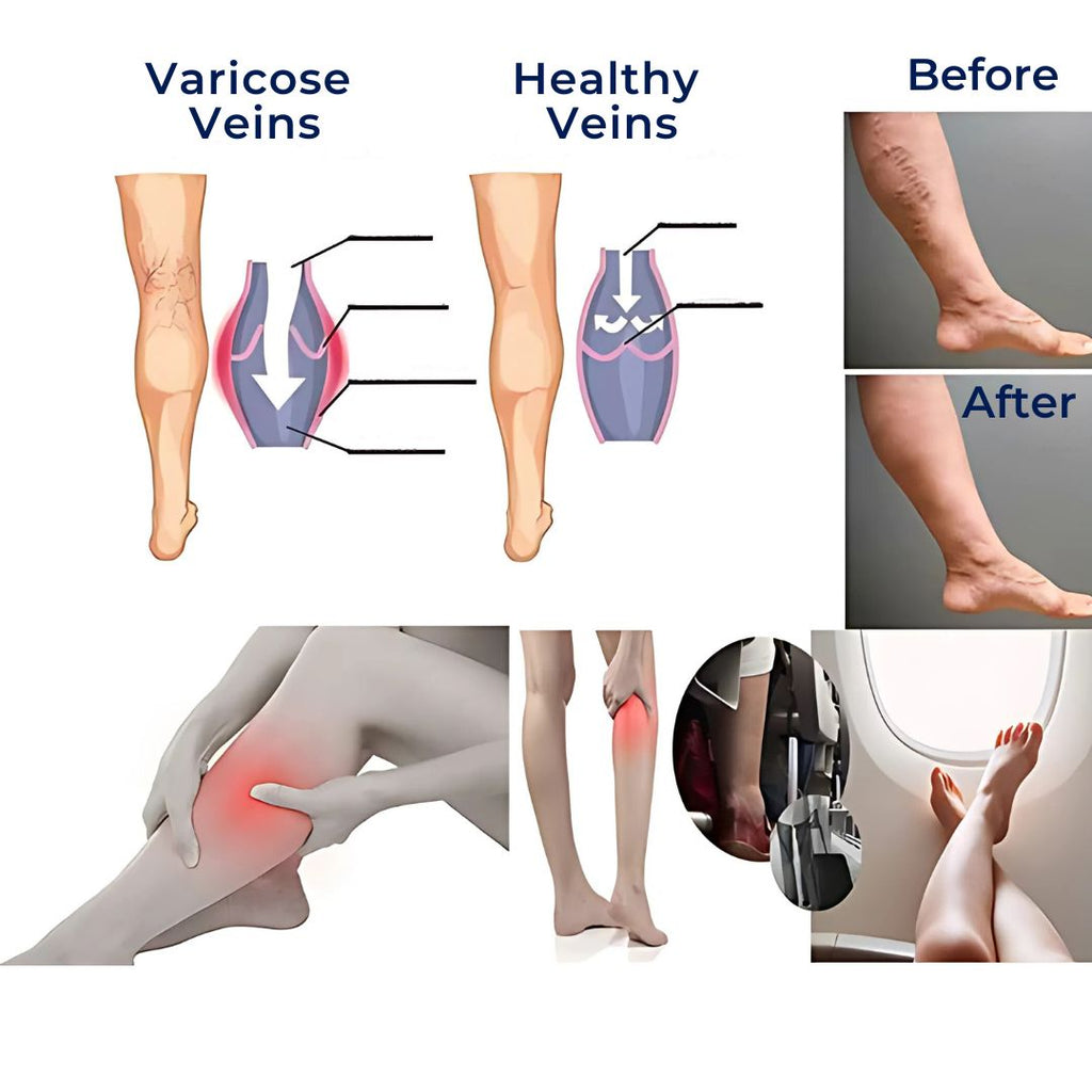 Medias de compresión CircuEase suaves y muy elásticas — diseño para la recuperación muscular y la mejora de la circulación