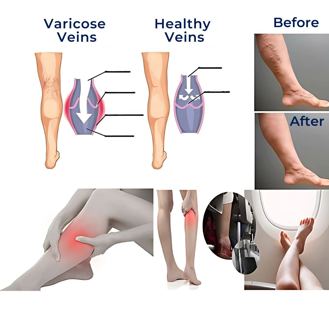Medias de compresión CircuEase suaves y muy elásticas — diseño para la recuperación muscular y la mejora de la circulación