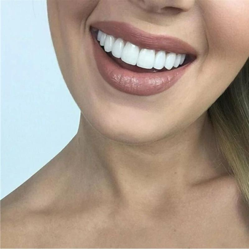 Kit de Sorriso Cosmético Instantâneo RYNX Repair — Capas Dentárias Concebidas por Dentistas