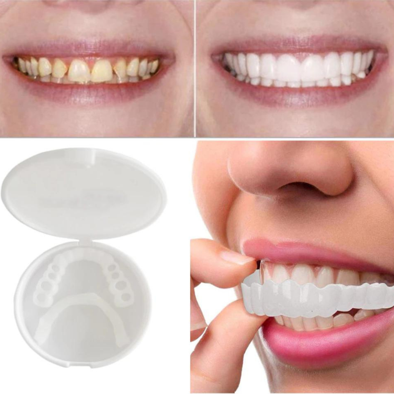 Kit de Sorriso Cosmético Instantâneo RYNX Repair — Capas Dentárias Concebidas por Dentistas