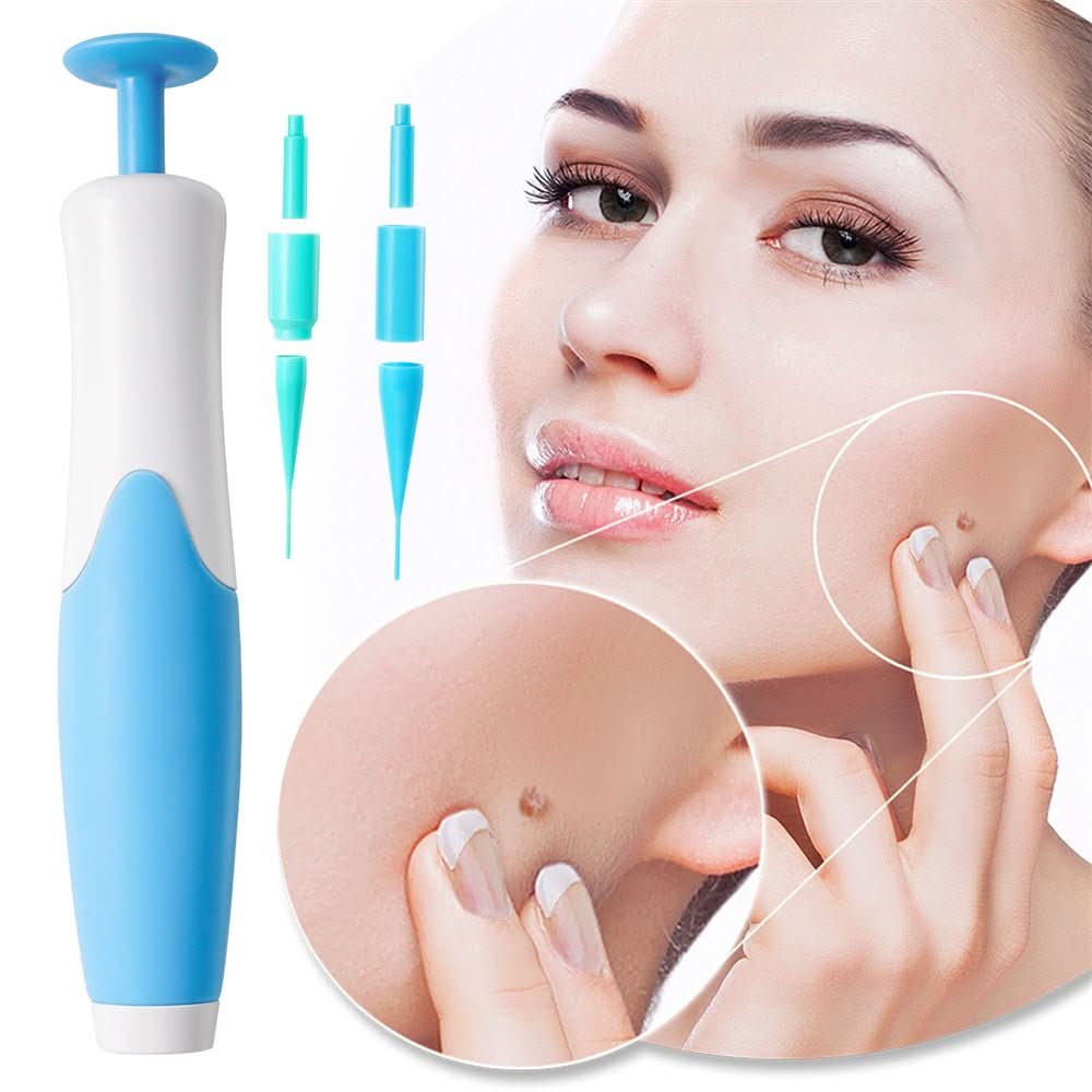 Painless Wart and Skin Tag Remover — Blood Restriction Method, 1 to 2 Weeks