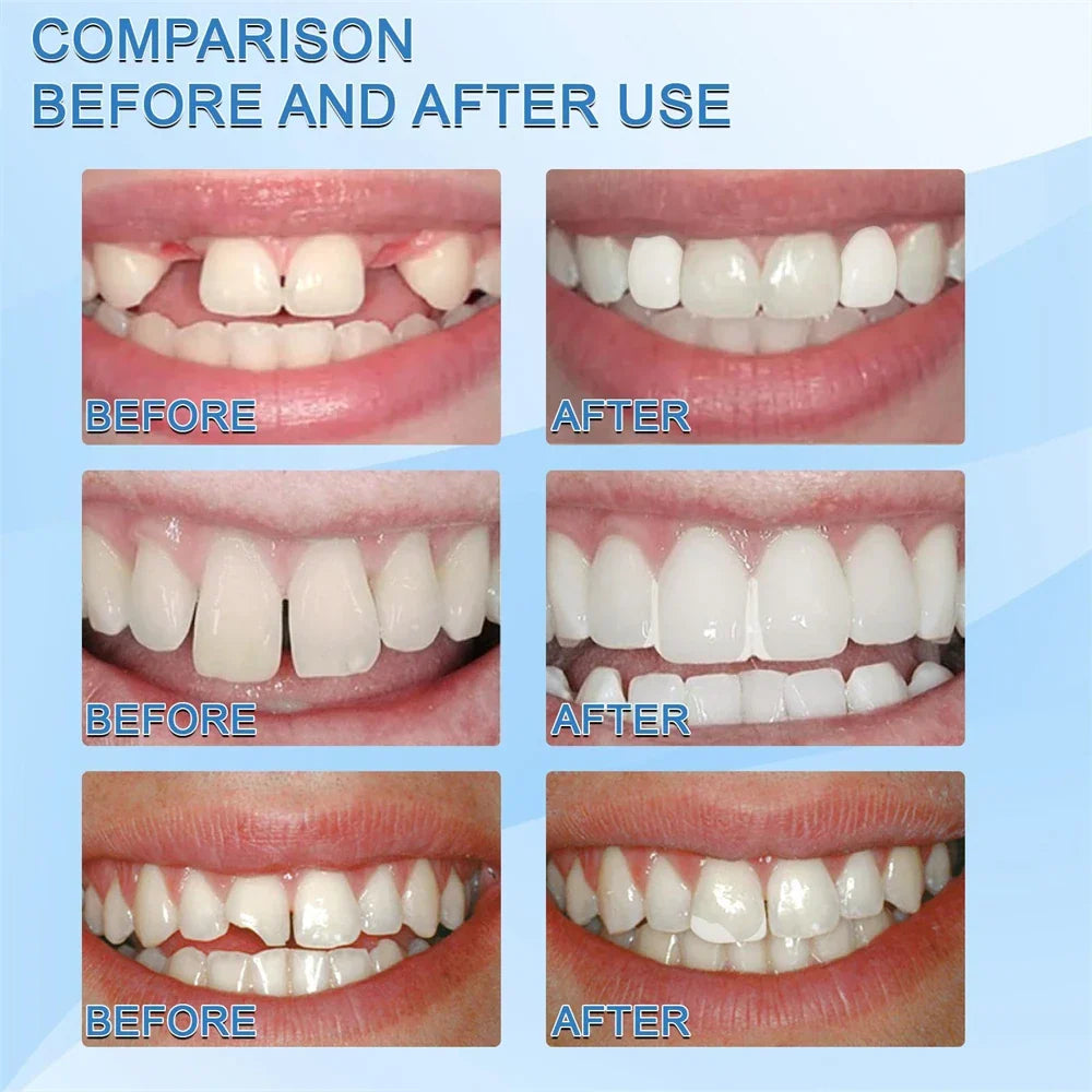Granuli per la riparazione temporanea dei denti ToothTite — Materiale per otturazioni dentali, 1+1 gratis!