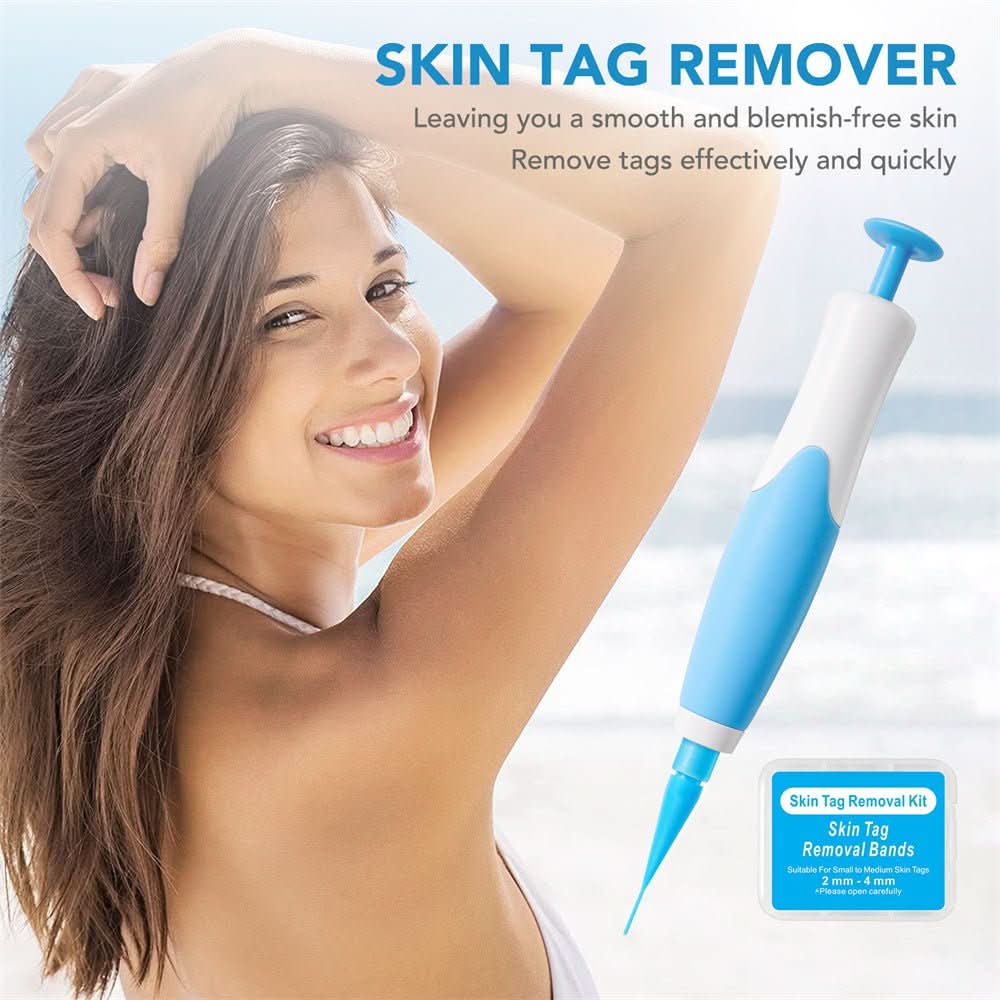 Painless Wart and Skin Tag Remover — Blood Restriction Method, 1 to 2 Weeks