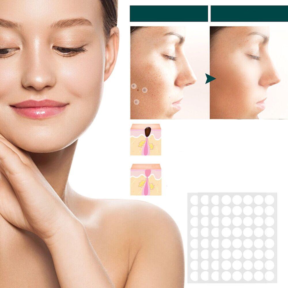 Patch adesivi SkinClear — Trattamento mirato per macchie, verruche e fibromi penduli