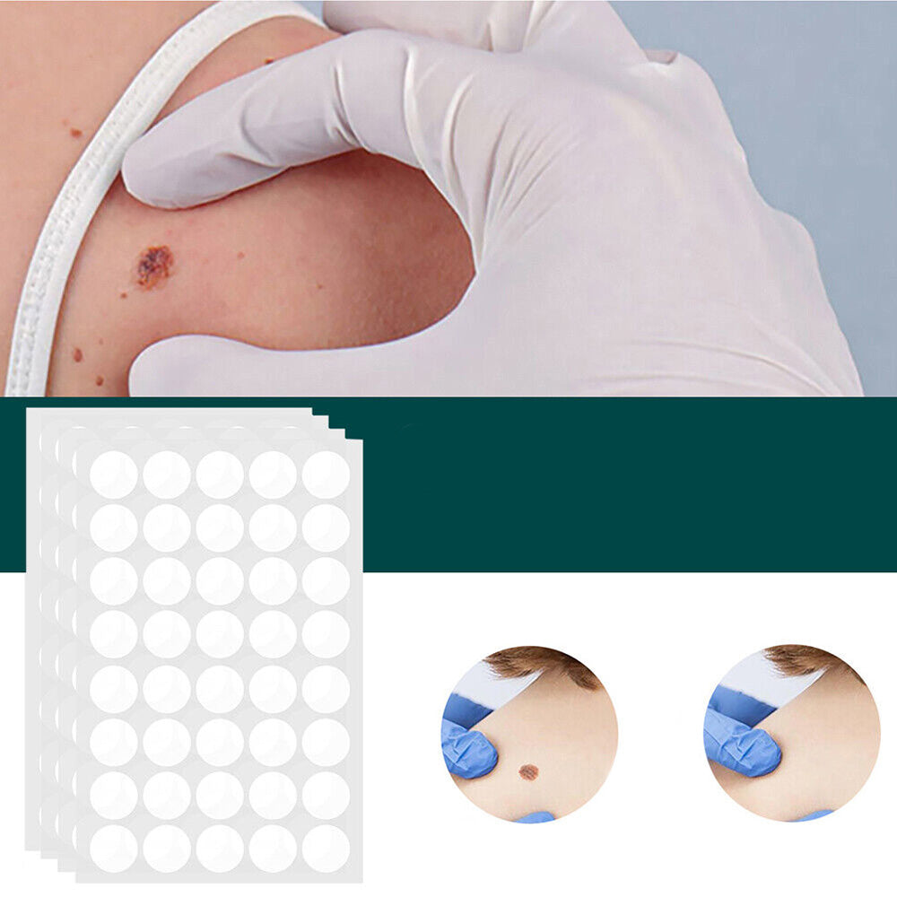 Patch adesivi SkinClear — Trattamento mirato per macchie, verruche e fibromi penduli