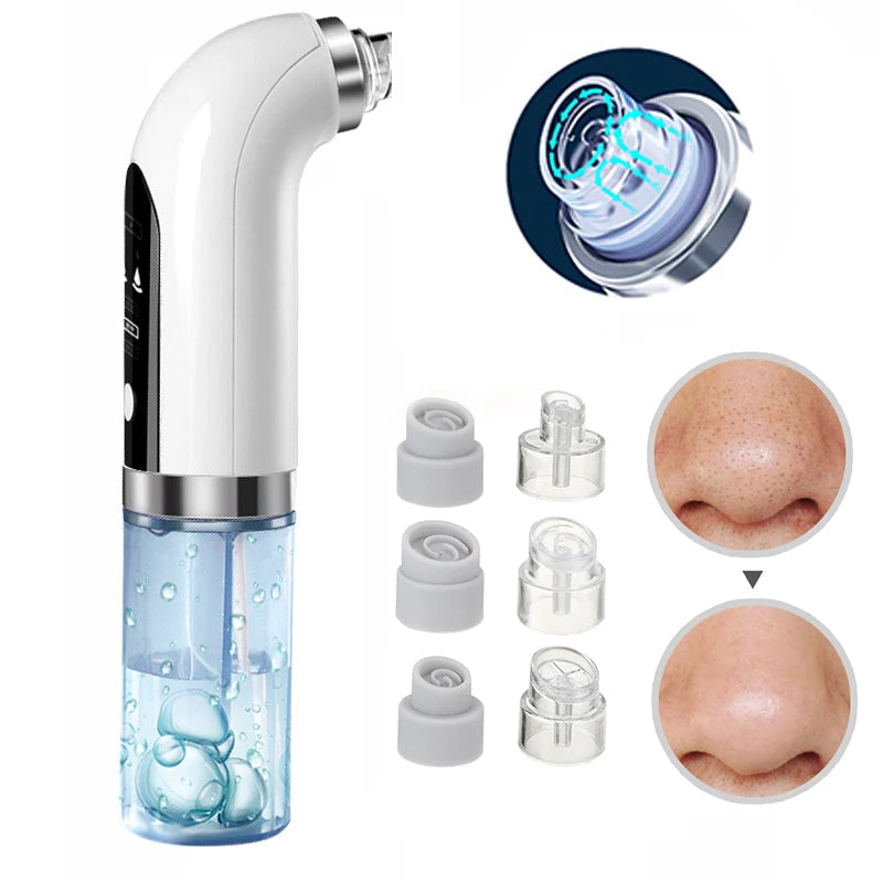 Handheld Blackhead Suction Vacuum – Deep Pore Cleaning Tool