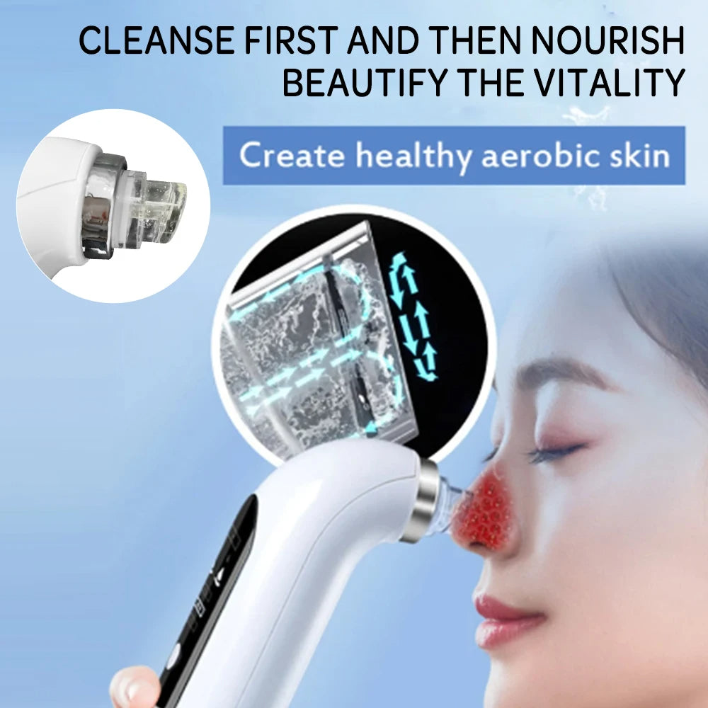 Handheld Blackhead Suction Vacuum – Deep Pore Cleaning Tool
