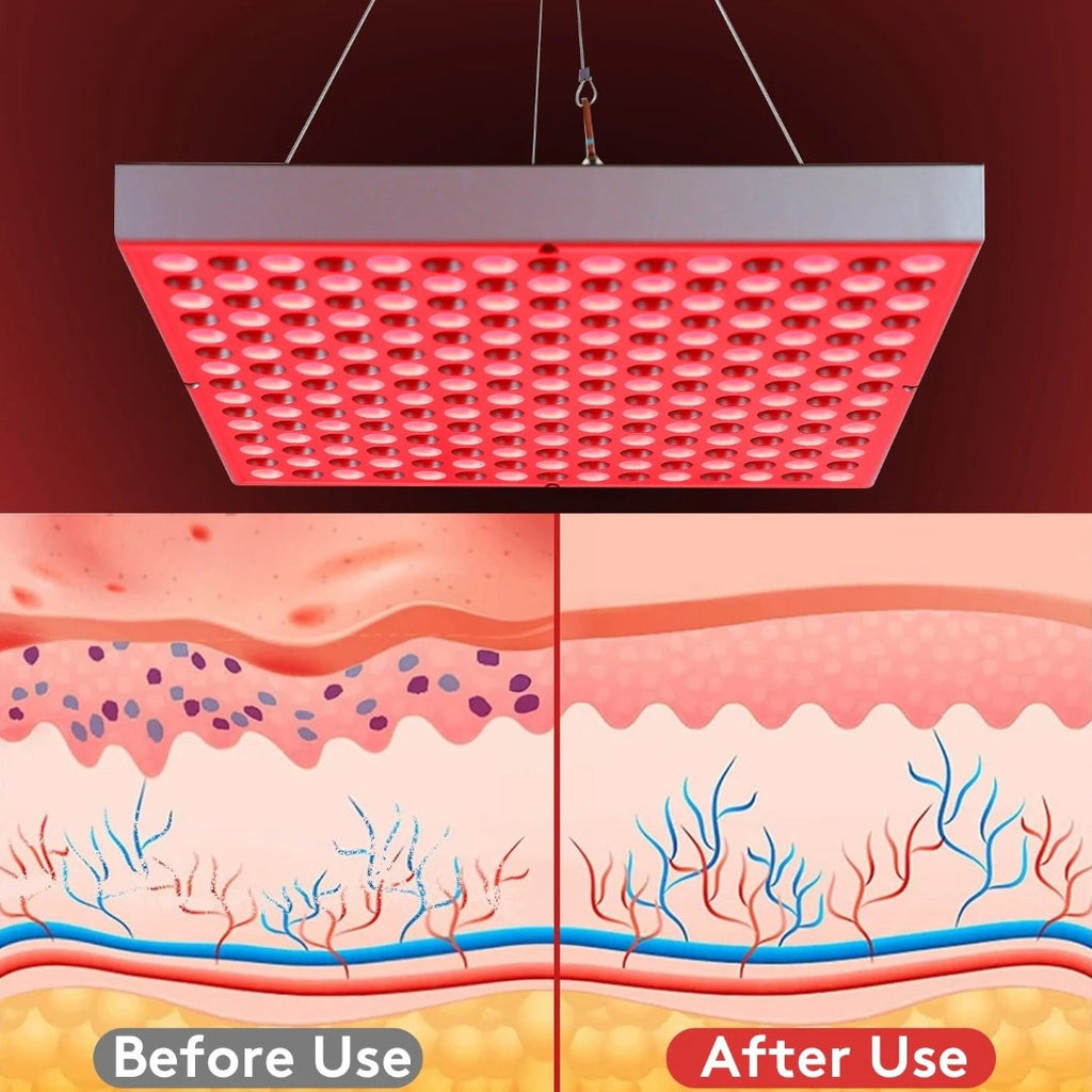 Orthopulse-Rotlichttherapiegerät – Gezielte Tiefengewebebehandlung, Muskelregeneration und Einschlafhilfe