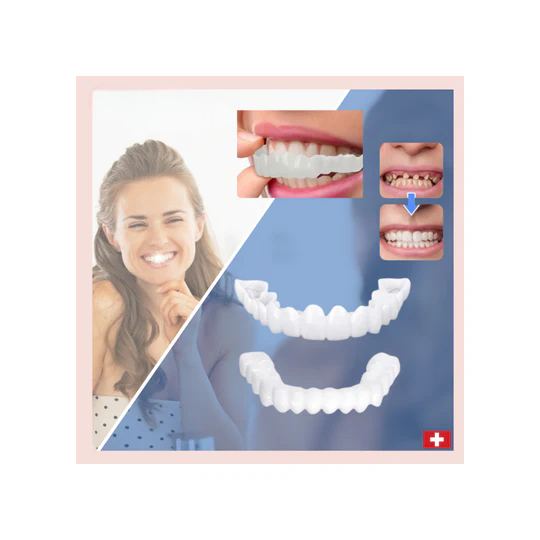 Kit de Sorriso Cosmético Instantâneo RYNX Repair — Capas Dentárias Concebidas por Dentistas