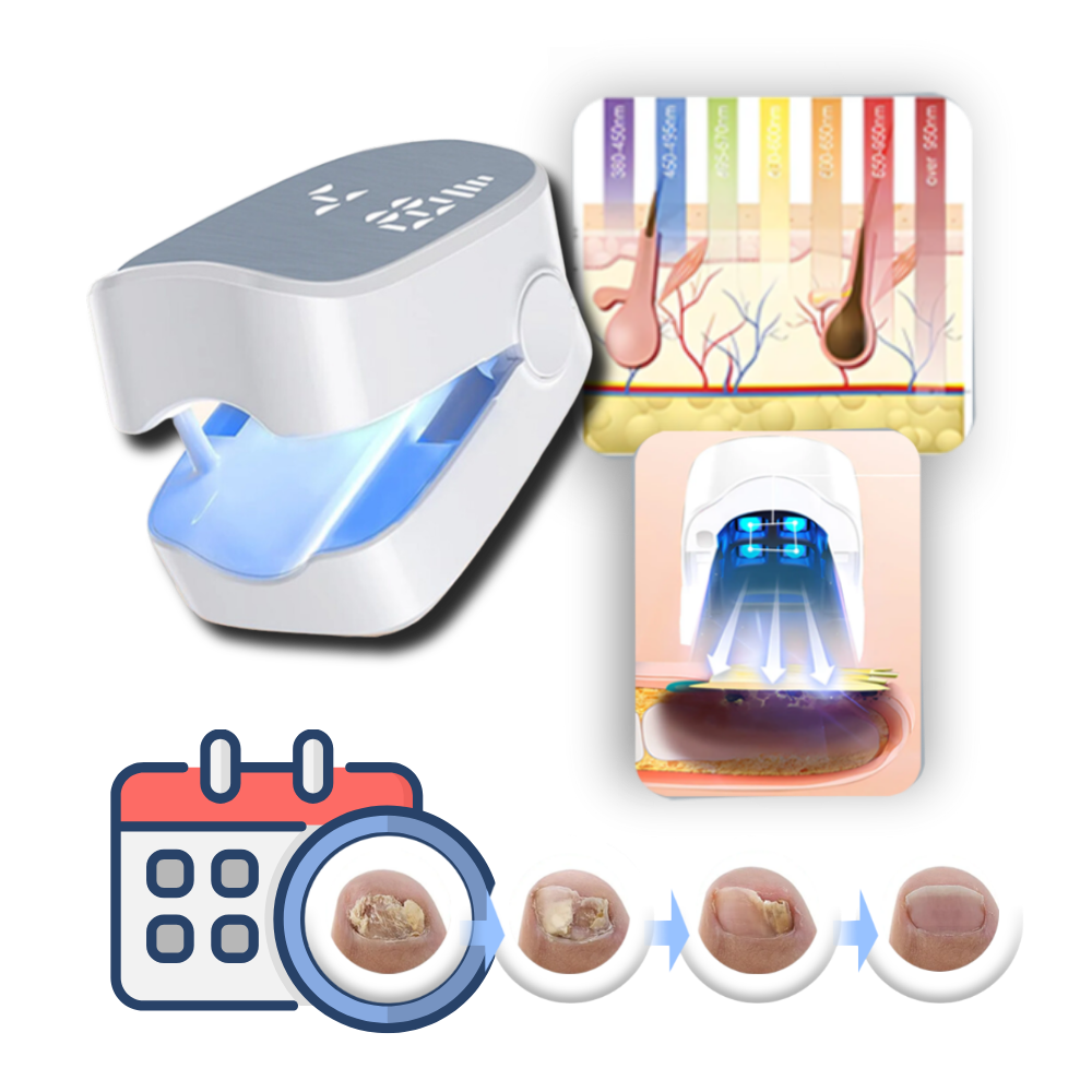 Láser indoloro para hongos en las uñas — dispositivo portátil de doble láser