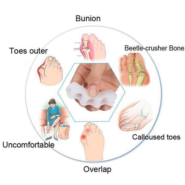 TeenRecovery orthopedische corrector voor hallux en hamertenen — geïntegreerde teenspreider, gladde contourvorm